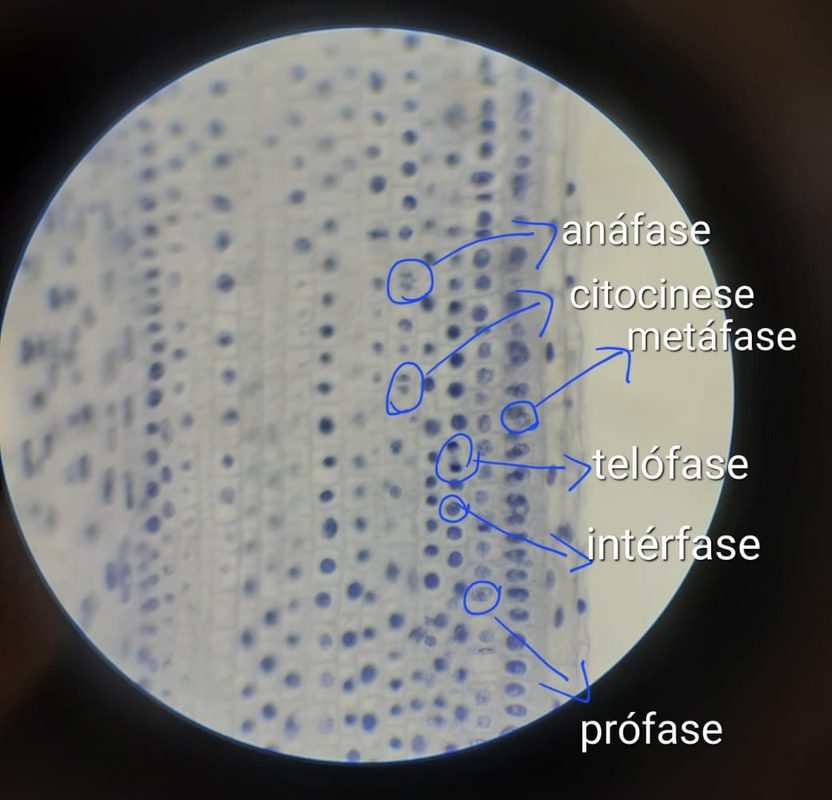 Fotografia ao microscópio de uma lâmina de raiz de cebola, com seis células marcadas à mão e identificadas como intérfase, prófase, metáfase, anáfase, telófase e citocinese.